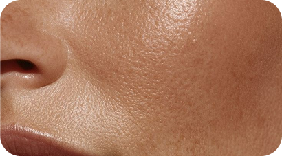 Why Does My Skin Feel So Stressed All the Time?